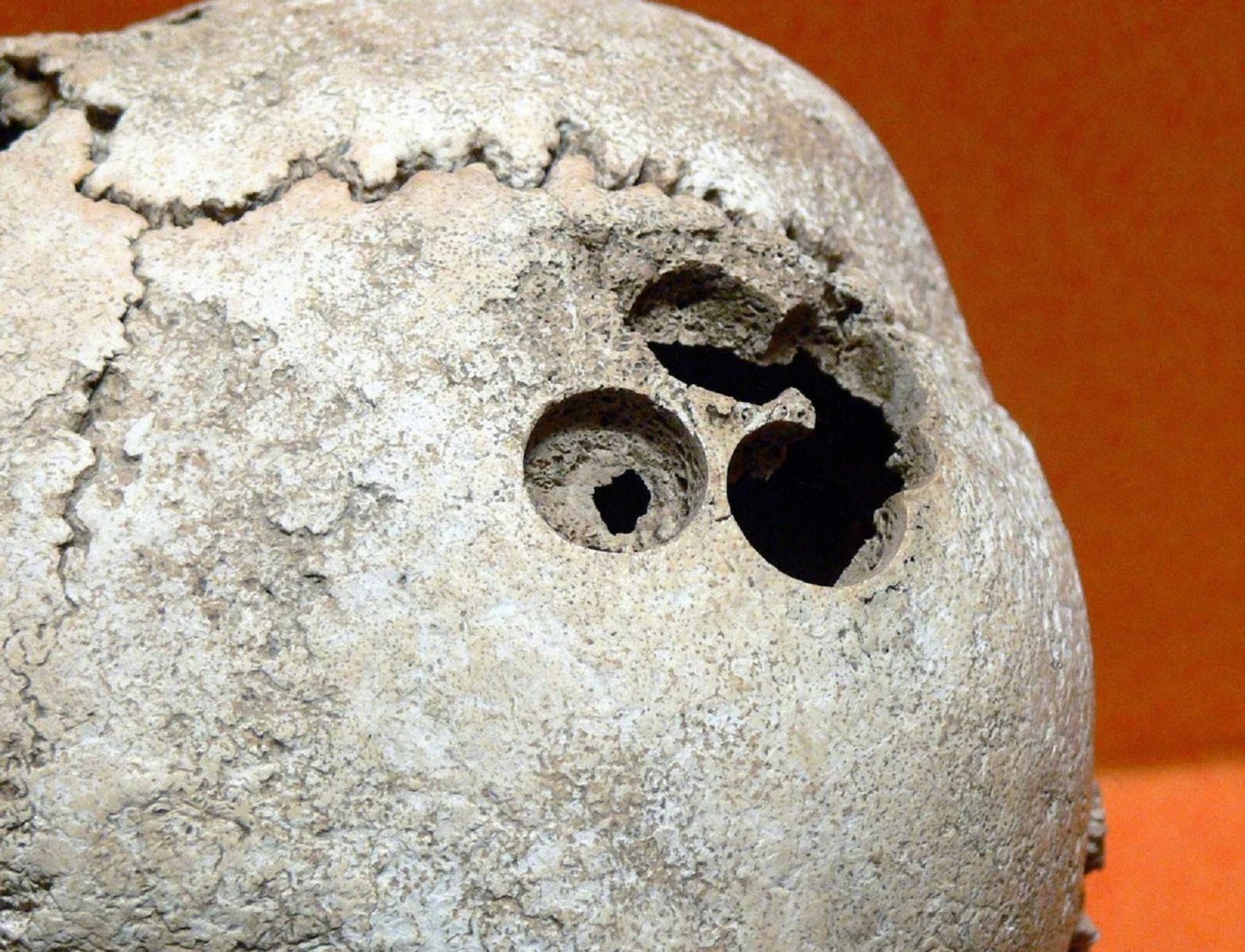 Лекция о древних операциях в Дарвиновском музее (онлайн) – события на сайте «Московские Сезоны»